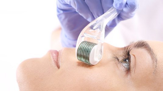 Medical Micro Needling - Skincare Treatments - Dublin