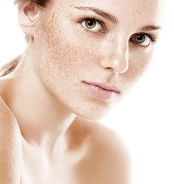 Pigmentation Treatments Dublin - Amara Skincare