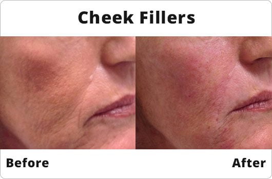 Amara Clinics | Anti Wrinkle Injections & Lip Fillers, Dublin