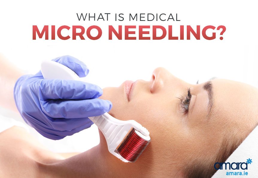 What Is Medical Micro Needling?