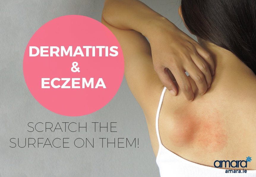 Dermatitis & Eczema - Let's Scratch The Surface! | Amara ...
