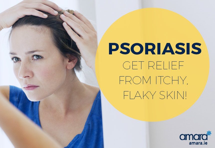 Psoriaris Treatment Dublin